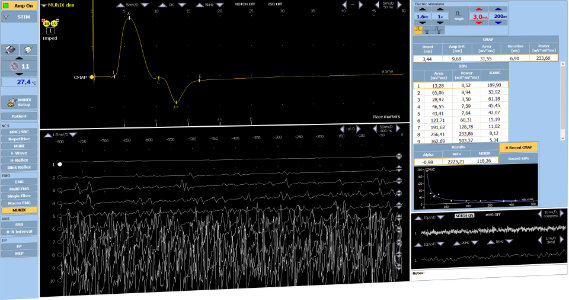 TrueTrace EMG Acquisition